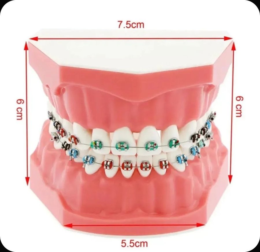 Макет челюсти с брекетами ортодонтическая